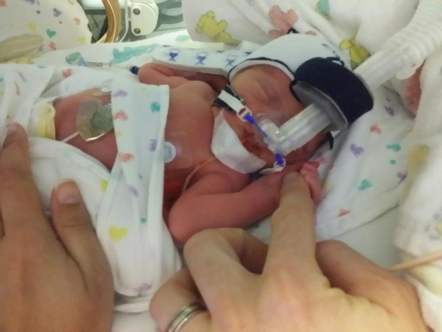 A baby hooked up to a breathing machine