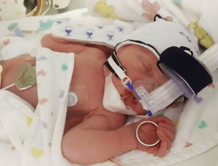 newborn baby in ICU